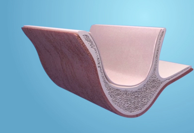 Sinus lift